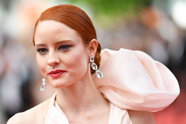 Winnie Harlow, la top con la vitiligine, conquista le passerelle. FOTO