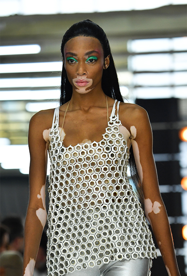 Winnie Harlow, la top con la vitiligine, conquista le passerelle. FOTO