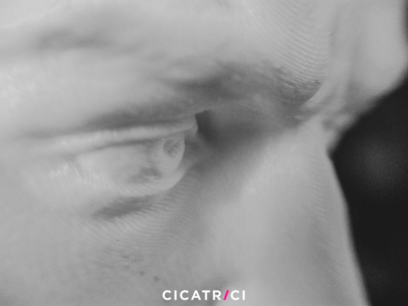 Cicatrici: conversazioni in mostra, racconti pubblici di emozioni private Cicatrici: conversazioni in mostra, racconti pubblici di emozioni private