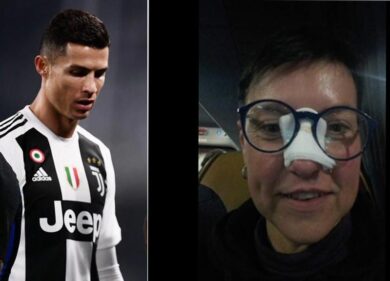 CRISTIANO RONALDO – COLPITA DA PALLONATA DI CR7, TIFOSA POSTA FOTO CON CEROTTO