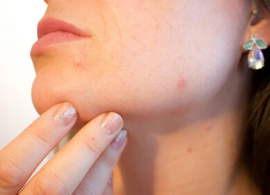 Tumori, tutte le forme di cancro che causano prurito