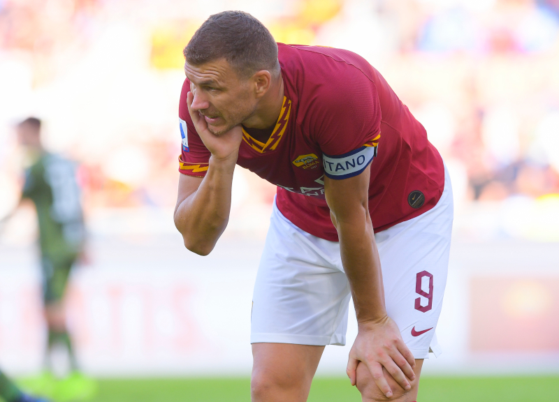 As Roma, Dzeko va ko: doppia frattura allo zigomo, operato a Villa Stuart As Roma, Dzeko va ko: doppia frattura allo zigomo, operato a Villa Stuart
