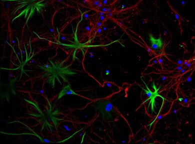 Patologie neurologiche e oncologiche, in Lombardia allo studio nuovi farmaci