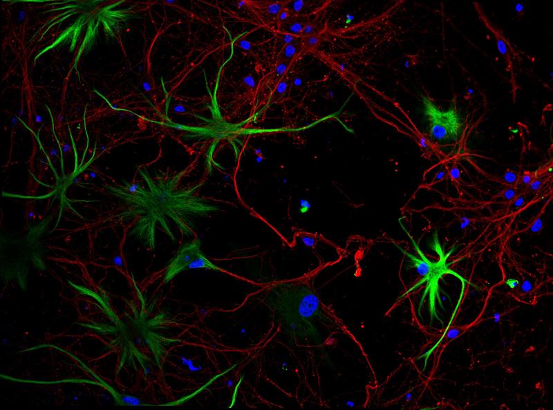 Patologie neurologiche e oncologiche, in Lombardia allo studio nuovi farmaci Patologie neurologiche e oncologiche, in Lombardia allo studio nuovi farmaci