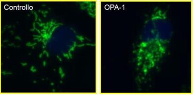 Parkinson, è lombarda la ricerca sulle super cellule in grado di contrastarlo