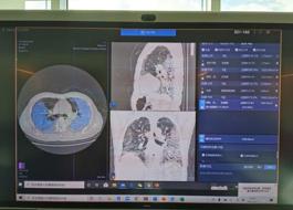 Coronavirus: Huawei e Retelit uniscono Napoli e Shanghai in videoconferenza