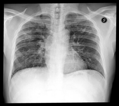 AI-for-COVID19: il CDI lancia la diagnostica predittiva