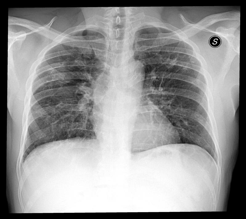 AI-for-COVID19: il CDI lancia la diagnostica predittiva AI-for-COVID19: il CDI lancia la diagnostica predittiva