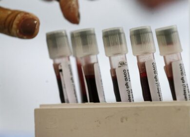 Coronavirus Roma, 23 casi. Tornano positivi dalle vacanze a Ibiza e Corfù