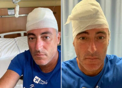 Gallera, infortunio al mare per l’assessore: 30 punti alla testa