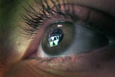 Smart working e caldo, come proteggere occhi e difese immunitarie