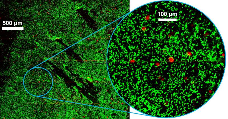 Politecnico di Milano, un flash di luce per identificare i tumori