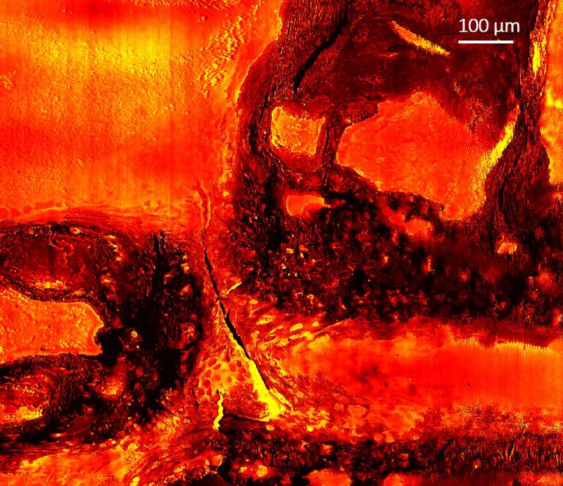 Politecnico di Milano, un flash di luce per identificare i tumori