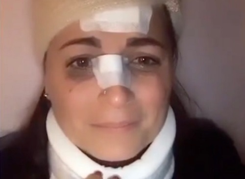 Infermiera aggredita sul bus a Milano: “Voglio giustizia” Infermiera aggredita sul bus a Milano: “Voglio giustizia”