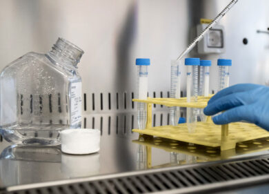 Covid, Speranza dà l’ok agli anticorpi monoclonali ma da Aifa molti dubbi