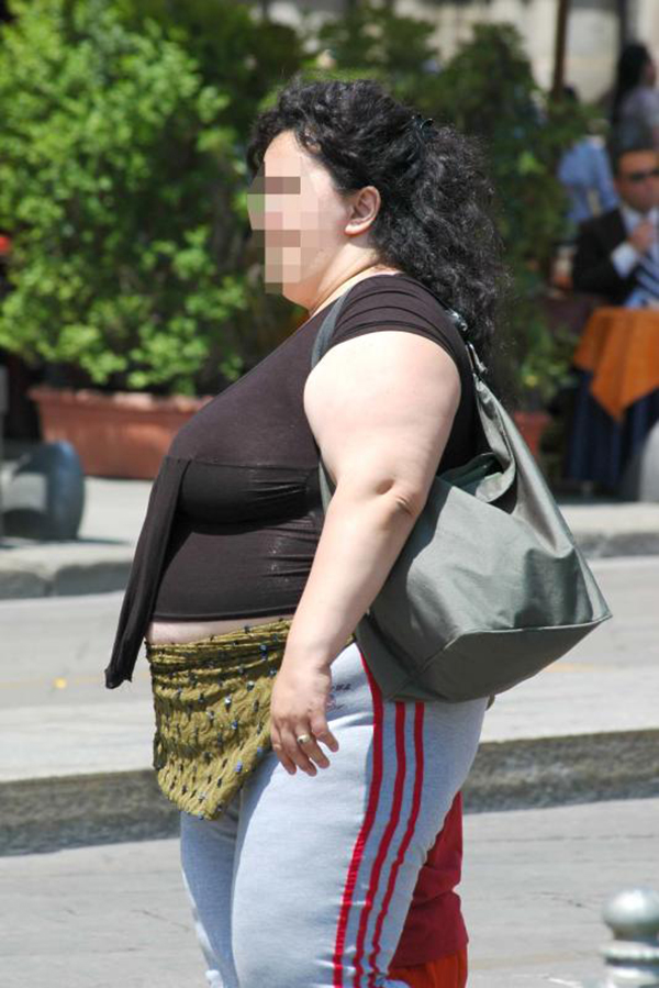 Obesi per colpa di un interruttore della fame nell’ipotalamo. La scoperta Obesi per colpa di un interruttore della fame nell’ipotalamo. La scoperta