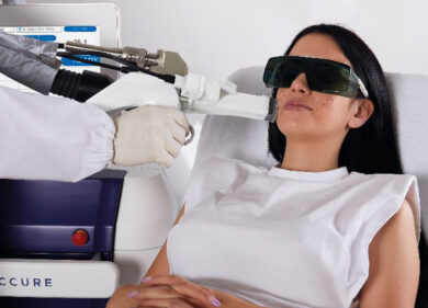 Nasce, grazie all’intelligenza artificiale, il nuovo laser ‘anti-acne’