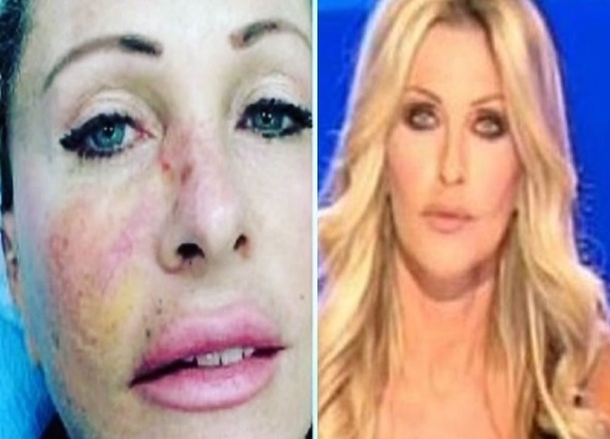 Paola Ferrari, la malattia non le risparmia le critiche: “Troppa luce in viso”