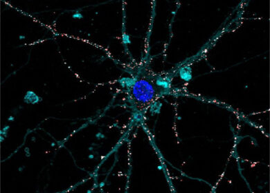 Novadido, nasce la start-up che studierà la prima retina artificiale liquida