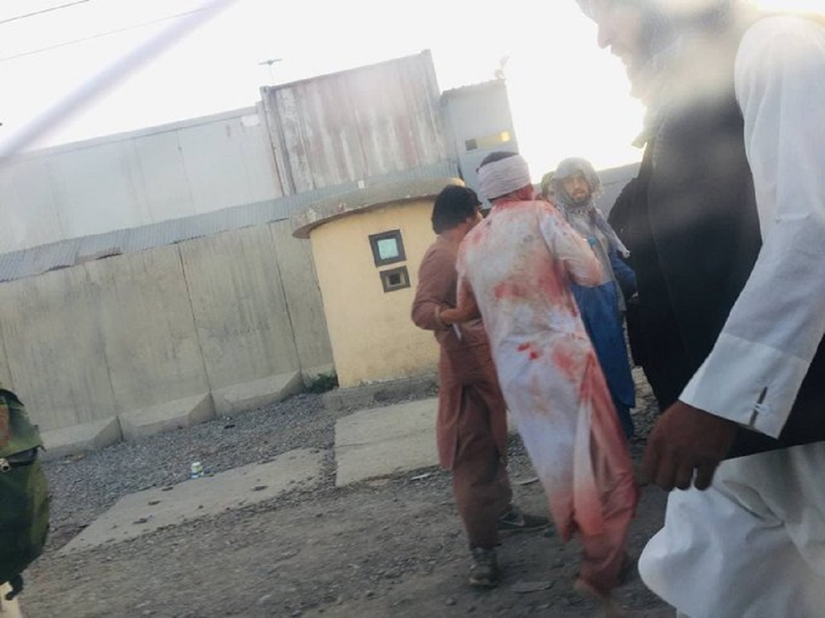 Afghanistan, kamikaze si fa esplodere all’aeroporto di Kabul: numerose vittime Afghanistan, kamikaze si fa esplodere all’aeroporto di Kabul: numerose vittime