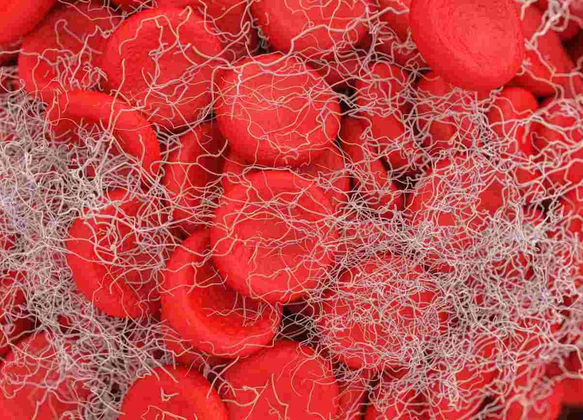 Il volto dell’ITP. Studenti dell’Accademia di Brera interpretano la malattia Il volto dell’ITP. Studenti dell’Accademia di Brera interpretano la malattia