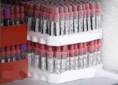 Usa, trovate fiale etichettate “vaiolo” in un laboratorio per vaccini