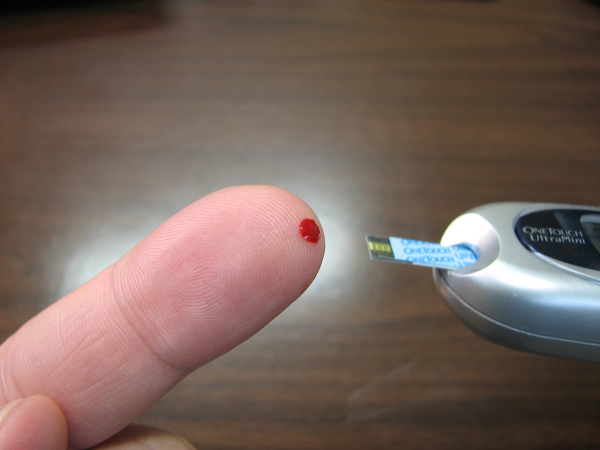 Diabete tipo 1, per la prima volta secreta insulina da staminali trapiantate Diabete tipo 1, per la prima volta secreta insulina da staminali trapiantate
