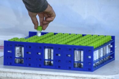 Deltacron: ecco la nuova variante Covid, mix Delta-Omicron. A Cipro 25 casi