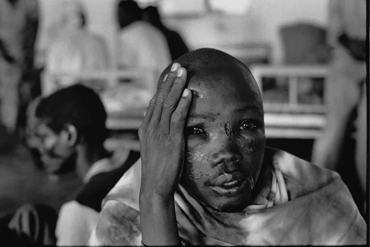 Medici Senza Frontiere e Cesare Pozzo: una mostra per raccontare l’umanità