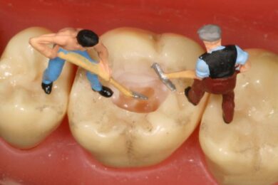 Dentista estraeva denti sani ai pazienti, un fatturato annuo da 2.6 milioni