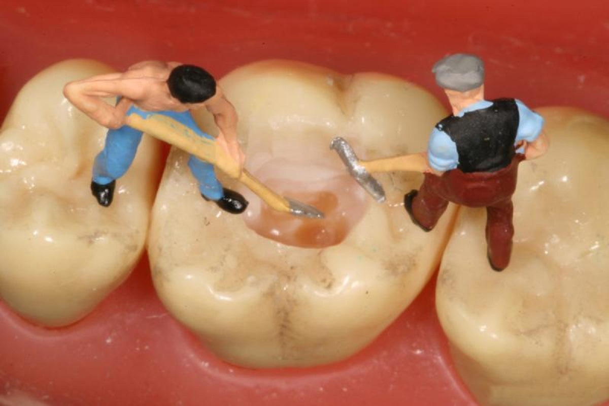 Dentista estraeva denti sani ai pazienti, un fatturato annuo da 2.6 milioni Dentista estraeva denti sani ai pazienti, un fatturato annuo da 2.6 milioni