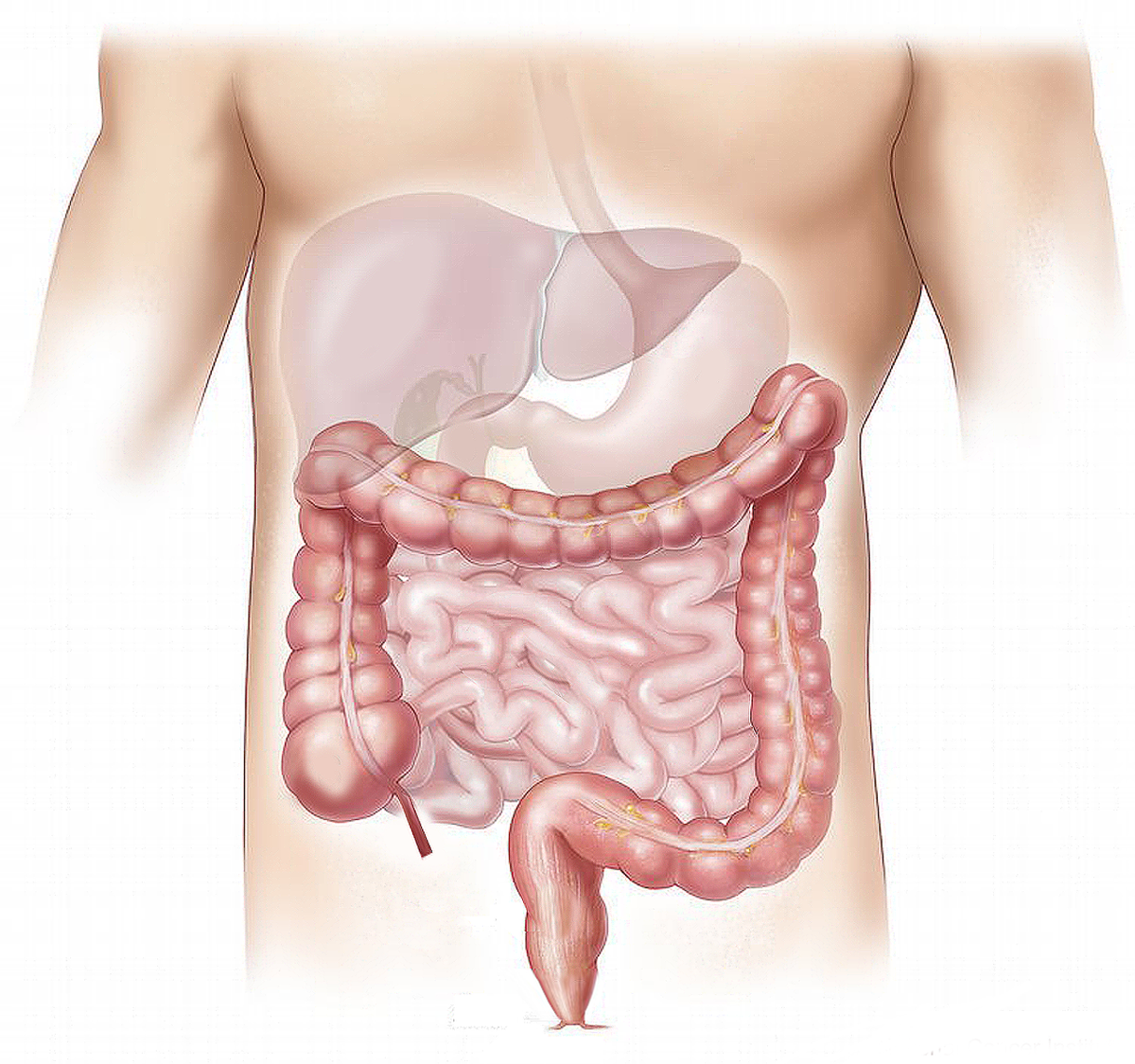 Tumore al colon, tra 50-70 anni dovreste fare un piccolo esame per prevenirlo Tumore al colon, tra 50-70 anni dovreste fare un piccolo esame per prevenirlo