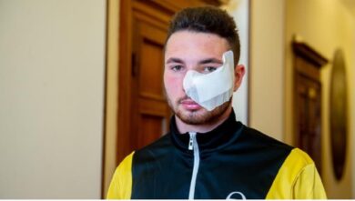 Verona, l’Inail risarcisce il rider sfregiato: 30 mila euro per le cure