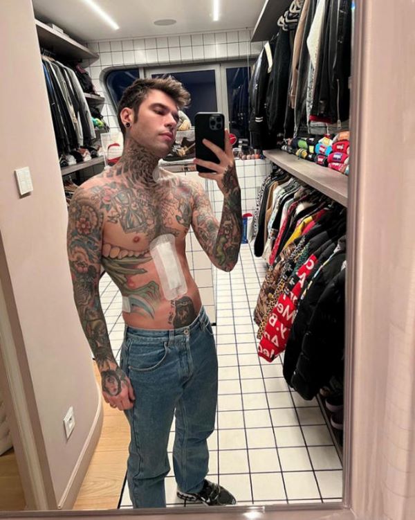 Fedez-Chiara, prima cena di coppia dopo l’operazione: “Brindo con gli enzimi” Fedez-Chiara, prima cena di coppia dopo l’operazione: “Brindo con gli enzimi”