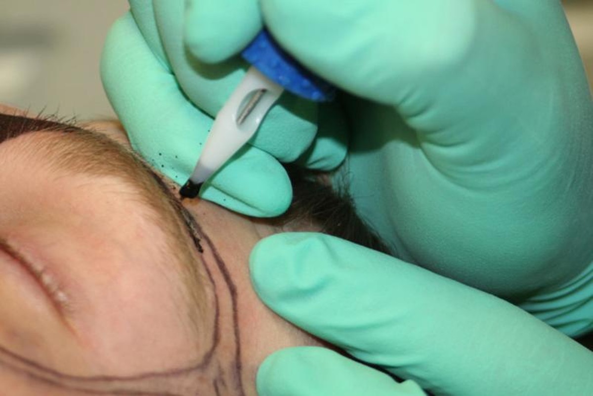 Costretta a tatuarsi il suo nome sul viso: 6 anni di carcere all’ex fidanzato Costretta a tatuarsi il suo nome sul viso: 6 anni di carcere all’ex fidanzato
