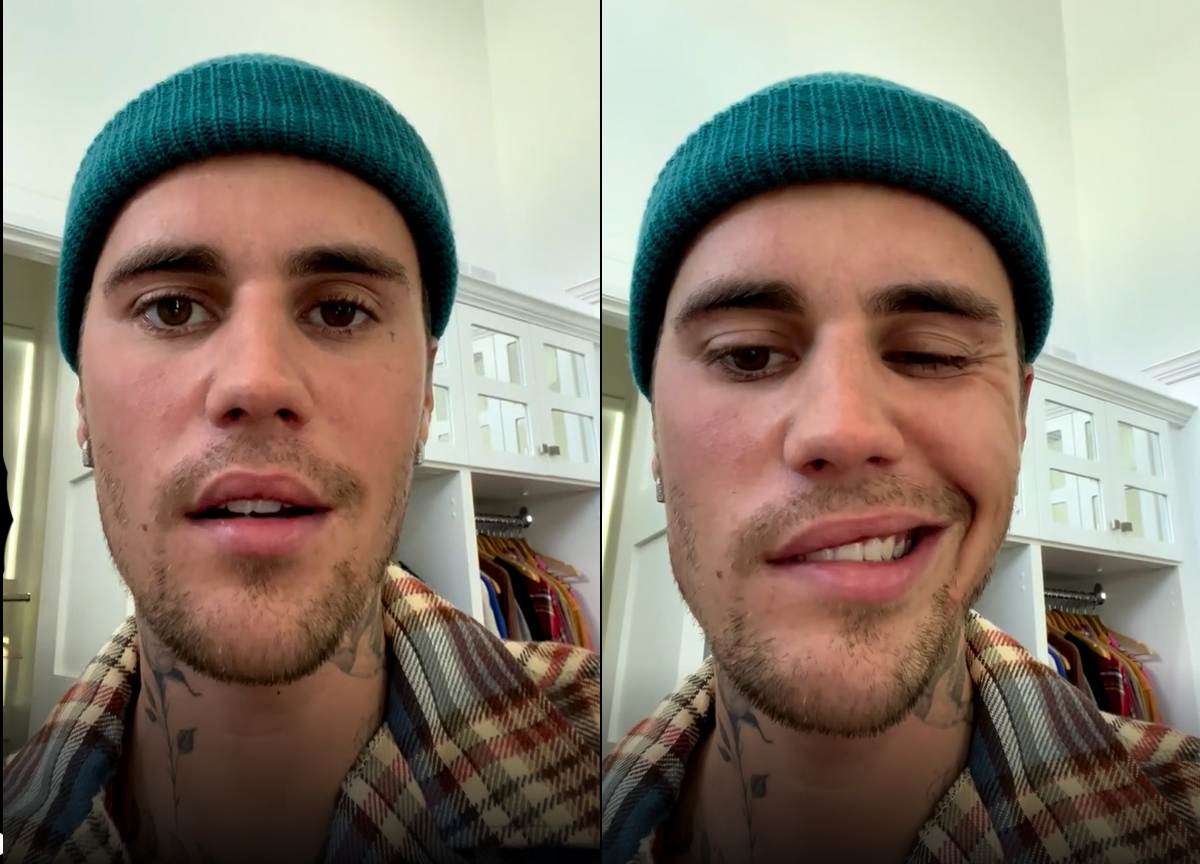 Justin Bieber ha una paralisi al volto: “Sto male, non posso cantare”. VIDEO Justin Bieber ha una paralisi al volto: “Sto male, non posso cantare”. VIDEO