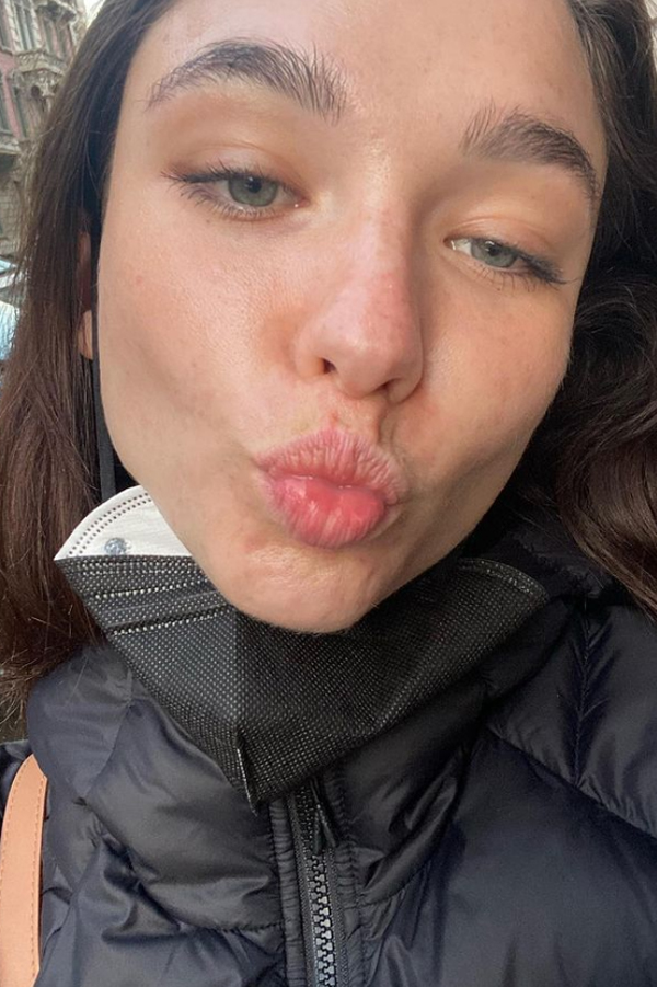 Matilda De Angelis choc: “Soffro d’ansia da tre anni” – FOTO