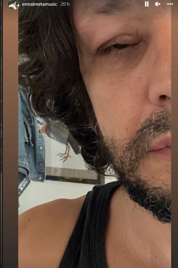 Ermal Meta: Ancora sconosciute le cause della malattia. Le foto choc