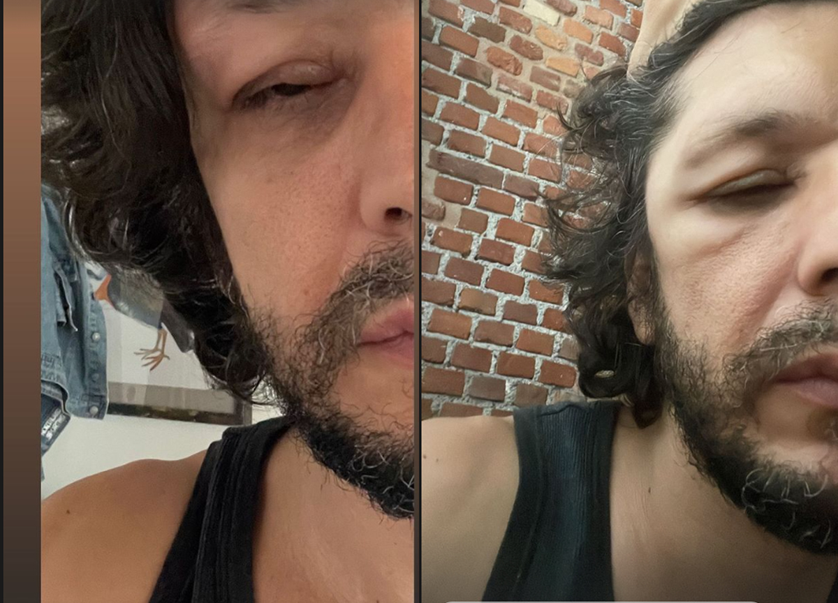 Ermal Meta: Ancora sconosciute le cause della malattia. Le foto choc