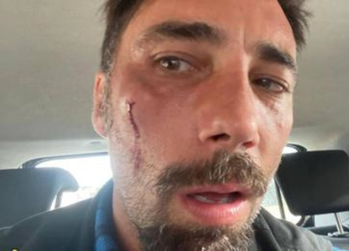 Brumotti, pistola puntata in bocca a Los Angeles: “Erano 4 ragazzi di colore”