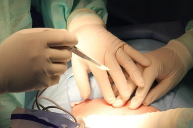 Rene sano rimosso per errore. Codacons: “Caso drammatico di malasanità”