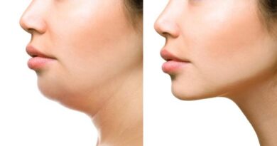 V – shape mania: tre tecnologie per un ovale perfetto – Dvora Ancona