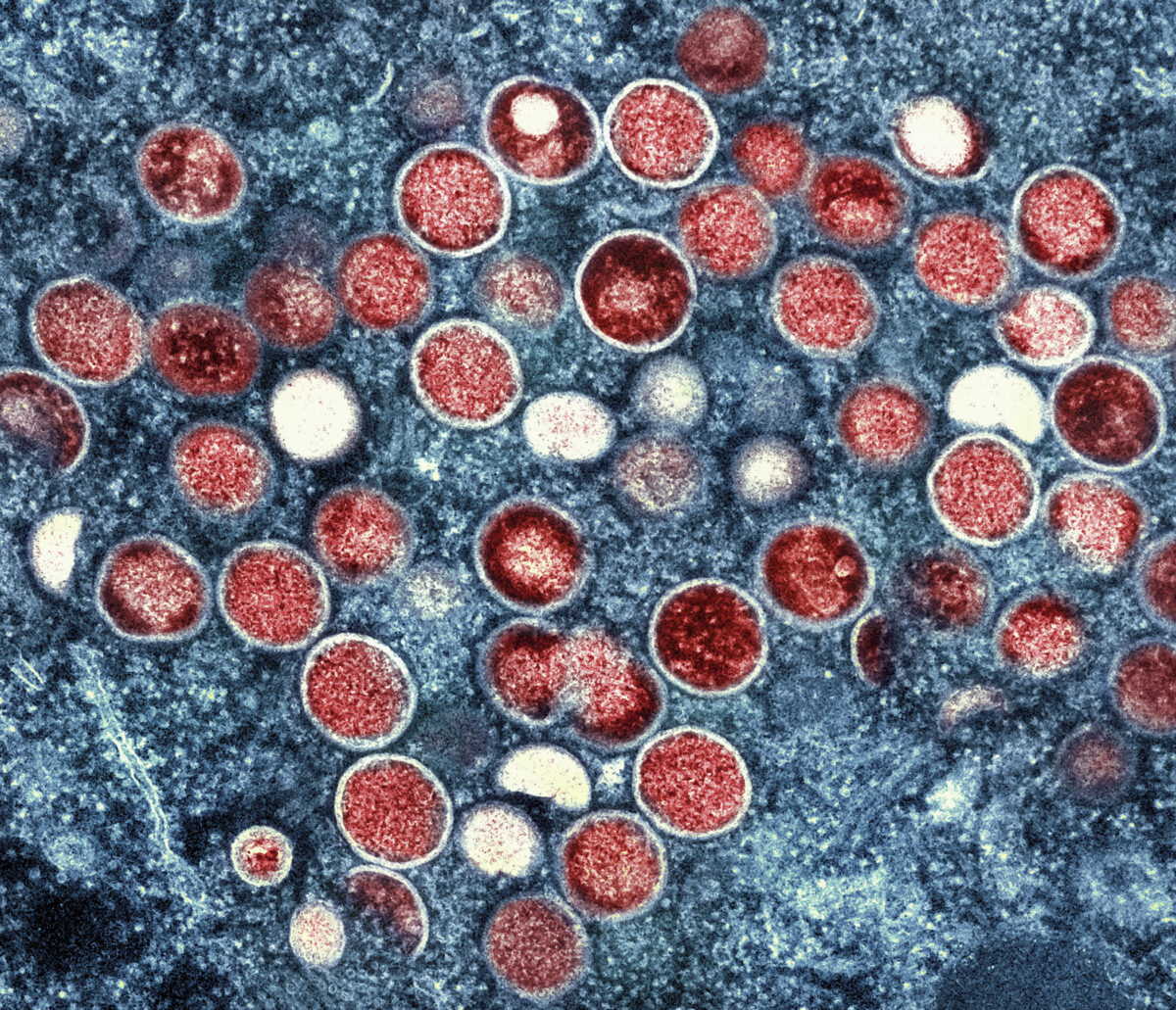 Tracce di vaiolo delle scimmie trovate nei testicoli di macachi convalescenti Tracce di vaiolo delle scimmie trovate nei testicoli di macachi convalescenti