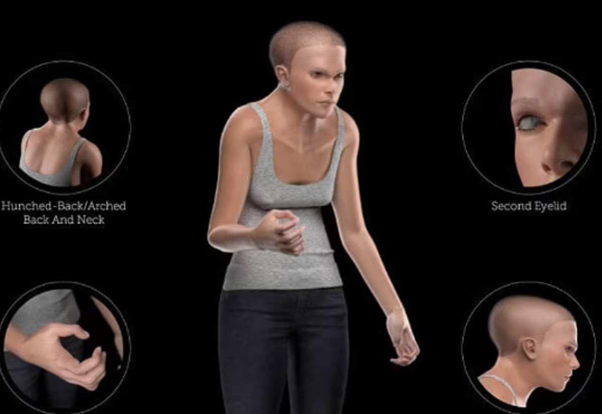 Gobbi, col cervello piccolo e occhi spiritati: ecco come sarà l’uomo nel 3000 Gobbi, col cervello piccolo e occhi spiritati: ecco come sarà l’uomo nel 3000