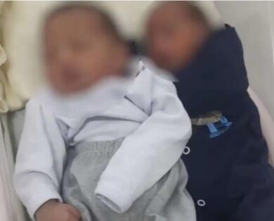 Ragazza partorisce due gemelli da due padri diversi