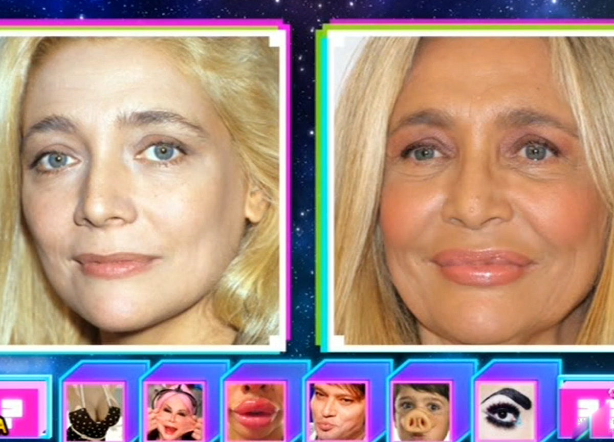 Mara Venier ha ceduto al ritocchino estetico? Il prima e il dopo. FOTO Mara Venier ha ceduto al ritocchino estetico? Il prima e il dopo. FOTO