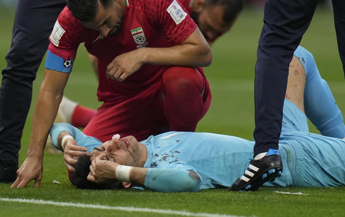 Mondiali, infortunio choc per Beiranvand. Giocatori Iran non cantano l’inno Mondiali, infortunio choc per Beiranvand. Giocatori Iran non cantano l’inno