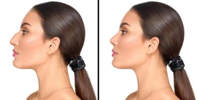 News dalla Corea: anche il naso si può rifare senza chirurgia! – Dvora Ancona