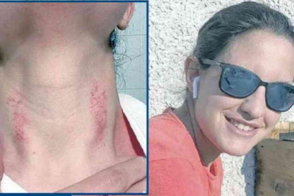 Udine, la dottoressa aggredita si arrende: “Basta non farò più il medico” Udine, la dottoressa aggredita si arrende: “Basta non farò più il medico”