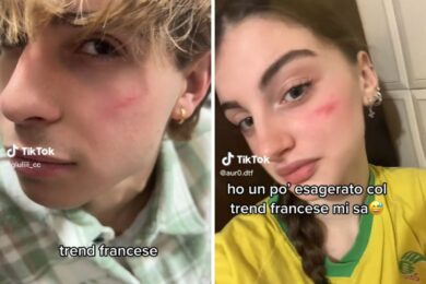 Che cosa è la cicatrice francese, l’ultima sfida e moda su TikTok